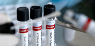 COVID-19 detection methods and infectivity COVID-19 test