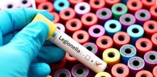 Legionella test