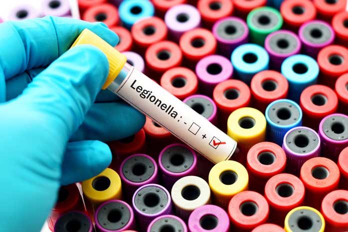 Legionella-positive-test Legionella test