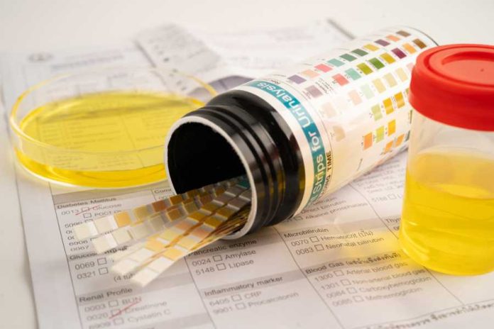 AdobeStock_1563002312 urinalysis